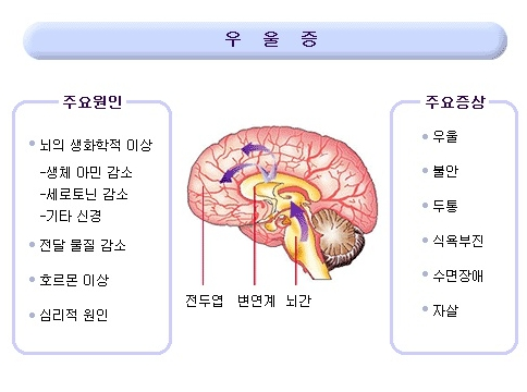 체험사례집_우울증(사진).png