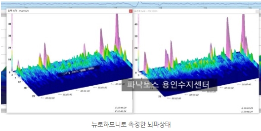 뉴로하모니 측정뇌파.jpg